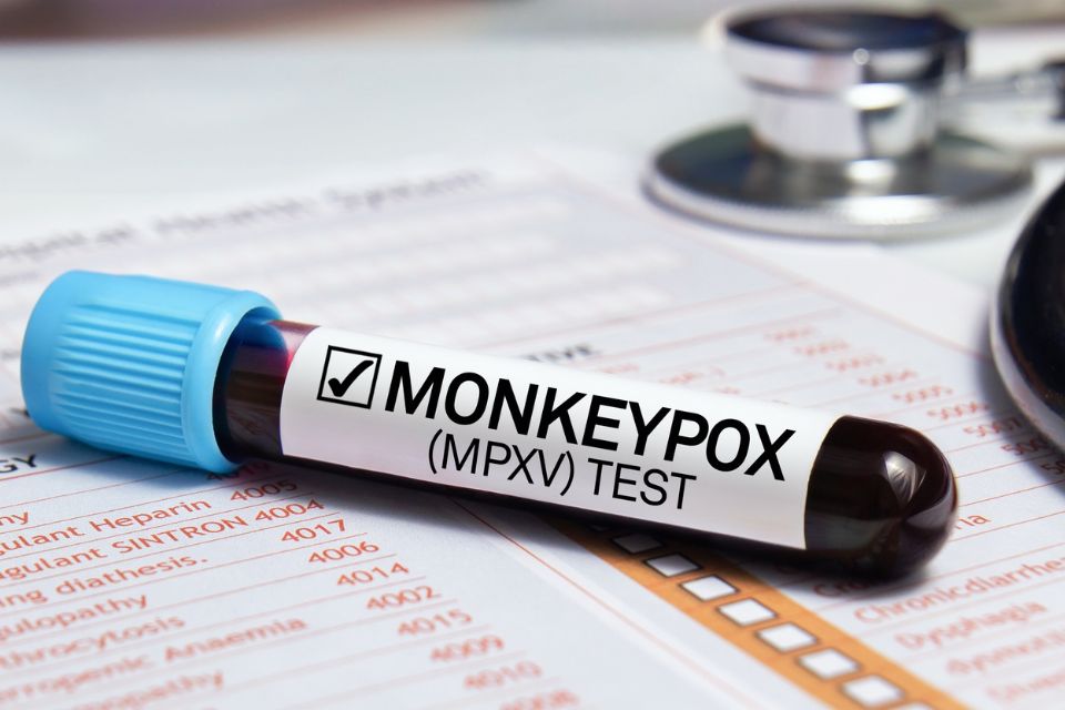 O que sabemos e não sabemos sobre o Monkeypox, a varíola de macaco