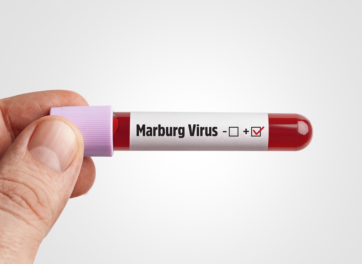 Gana confirma duas mortes causadas pelo vírus Marburg