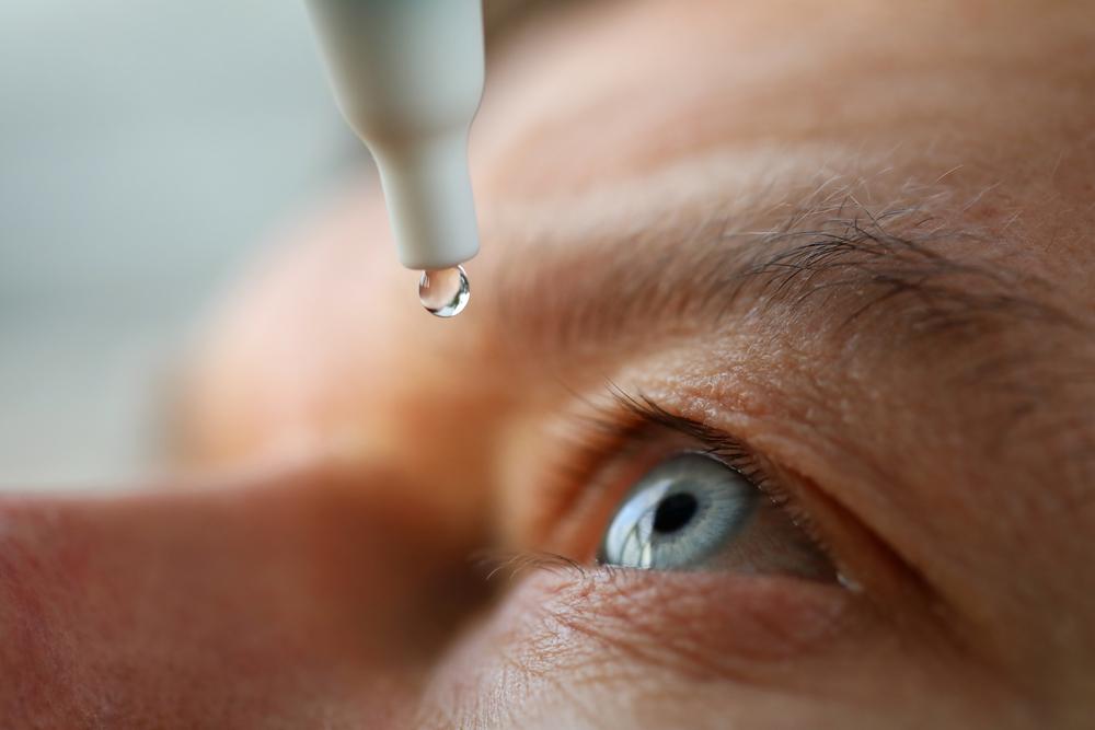 The syndrome can be treated with eye drops (Source: Shutterstock