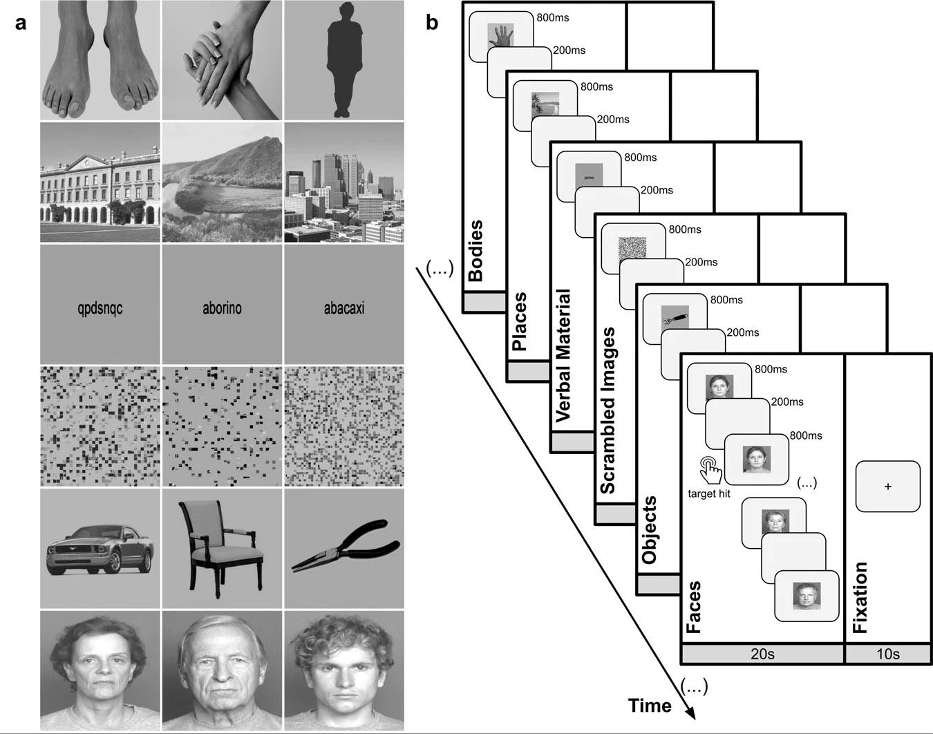 Projeto de tarefa com imagem por ressonância magnética funcional - fMRI. (Fonte: Canário et al./Divulgação.)