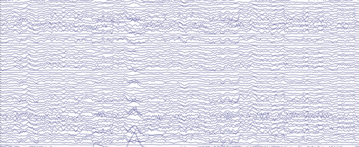Atividade cerebral de um participante do estudo, registrada em várias localidades do couro cabeludo pelo eletroencéfalograma
