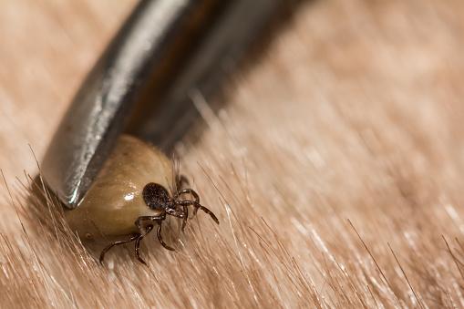 Caso não seja possível prevenir o carrapato, o inseto deve ser removido de forma adequada. (Fonte: GettyImages/Reprodução)