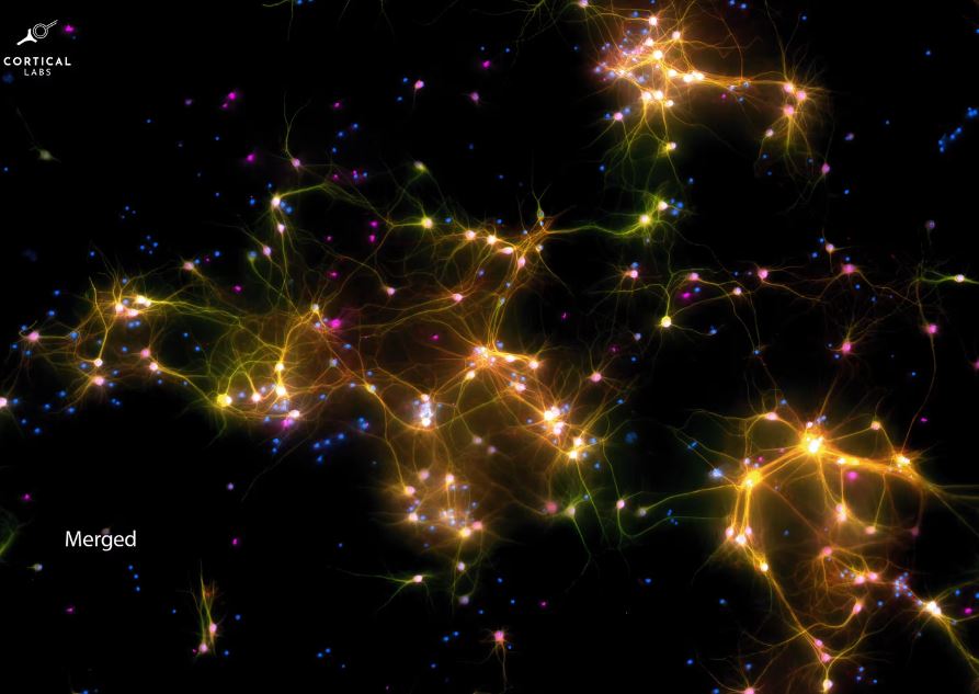 Na imagem, as partes destacadas pela cor fluorescente representam as células humanas e de camundongos.