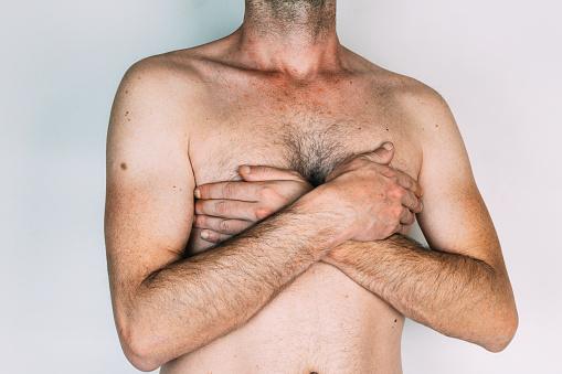 A ginescomastia pode levar os homens a terem vergonha do próprio corpo. (Fonte: GettyImages/Reprodução)