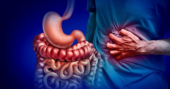 Síndrome do intestino irritável: problemas emocionais e alimentares podem ser as causas. (Fonte: GettyImages/Reprodução)