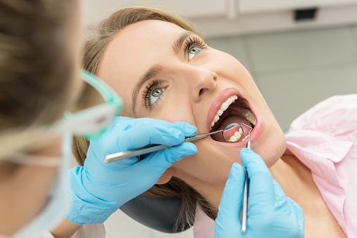 retirada somente pode ser feita por um dentista, que fará uma raspagem com instrumentos apropriados.