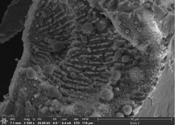 The picture shows the internal structure of the spheres, which consist of microspheres ranging in diameter from 5 to 10 microns.