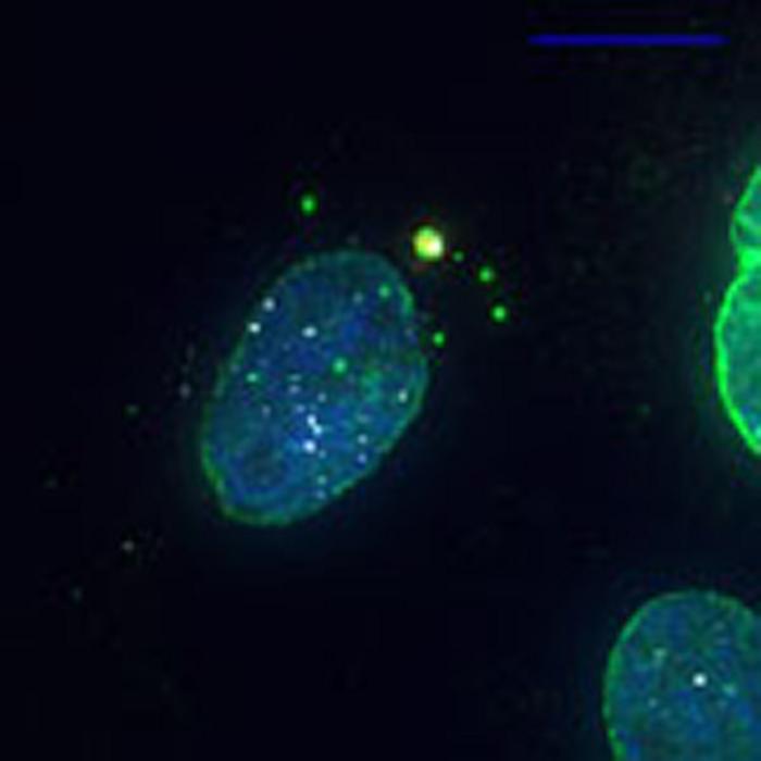 O exclusoma é o ponto verde e amarelo boiando no citoplasma, fora do núcleo.