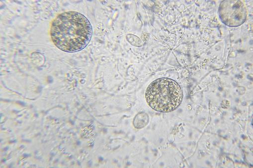 Chlamydomonas is a genus of green algae consisting of approximately 150 species of single-celled flagellates.