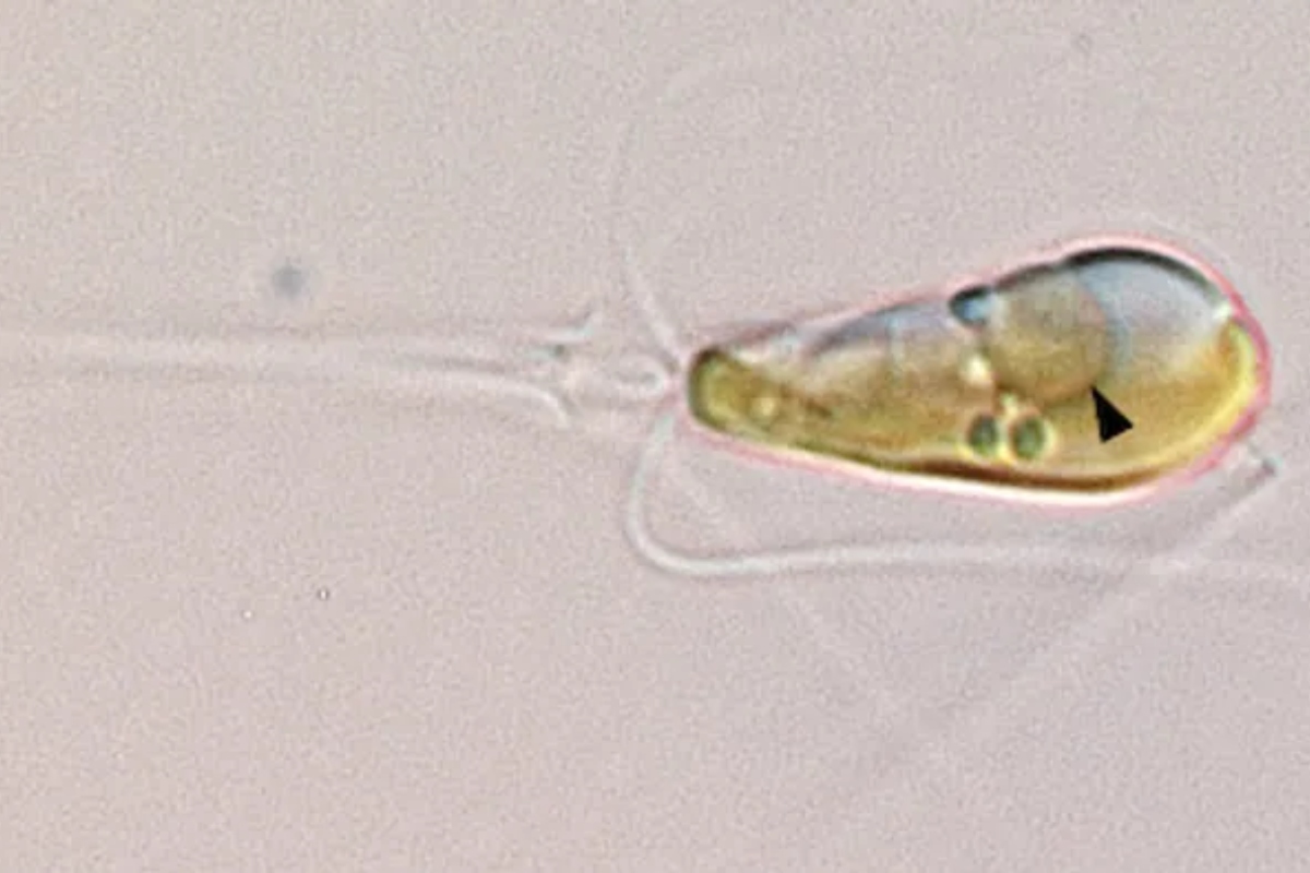Pesquisadores identificaram caso de endossimbiose entre alga marinha e bactéria UCYN-A. (Fonte: Tyler Coale/UCSC) 