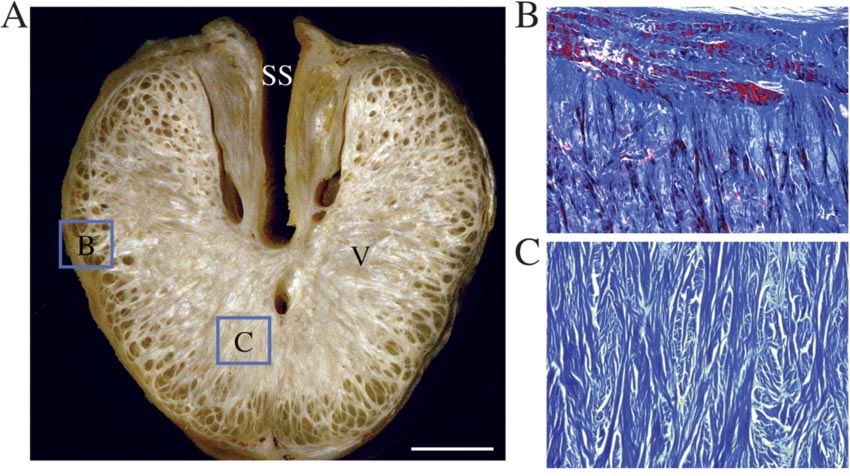 Imagem mostra a estrutura interna do pênis dos jacarés, composto de densas camadas de colágeno que o deixam sempre eretos (Fonte: Diane Kelly/Reprodução)