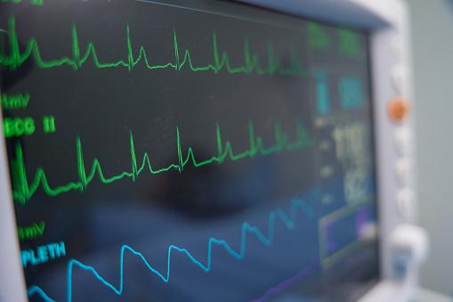 Pessoas com histórico de cardiopatias não devem fazer o procedimento. (Fonte: Getty Images/Reprodução)