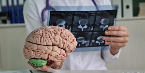A atividade cerebral foi monitorada em diferentes atividades, procurando sinais de ativação neuronal. (Fonte: Getty Images/Reprodução) 
