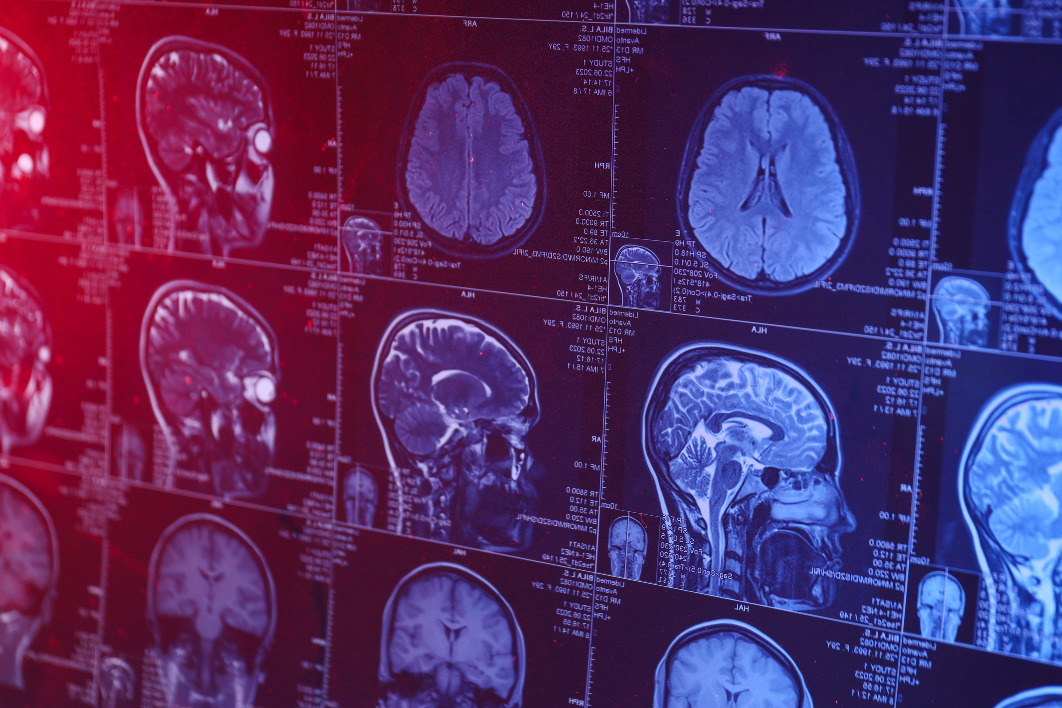 Neurocientista explica o que acontece no cérebro enquanto morremos