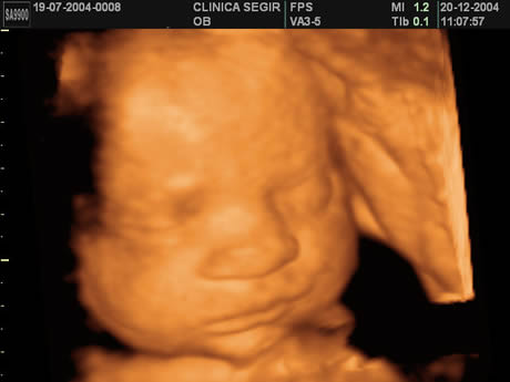 Como Funcionam A Tomografia E A Ecografia 3d Tecmundo