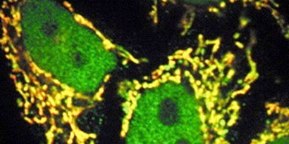 Imagem de: Computador biológico detecta e destrói células cancerígenas